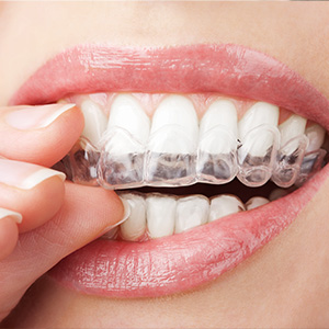 Powell TN Cosmetic Dentist,
