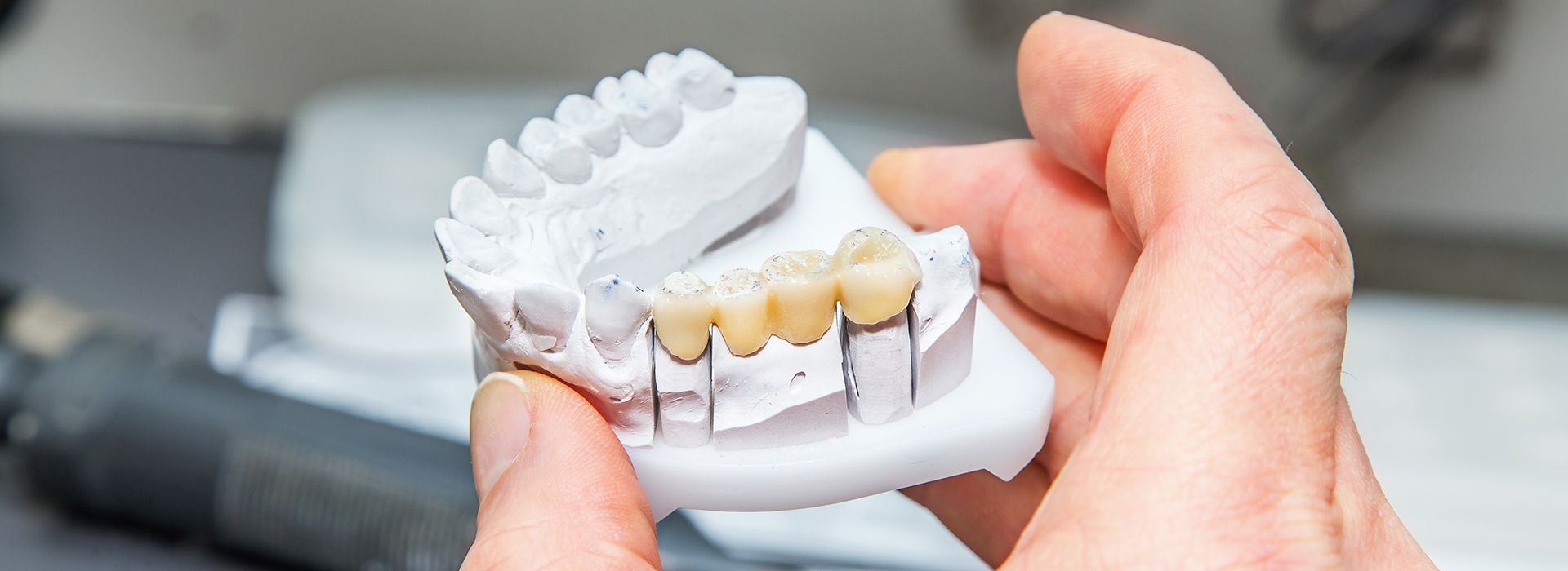 Kennedy Dentistry | Veneers, CBCT and Invisalign reg