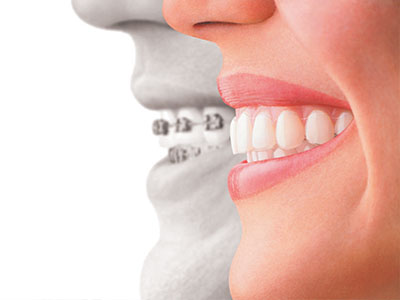 Kennedy Dentistry | Sports Mouthguards, Veneers and Digital Radiography